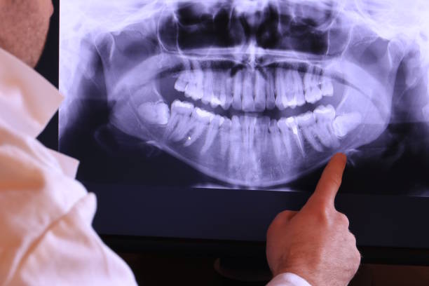 Best Dental Abscess Treatment in Jackson, GA